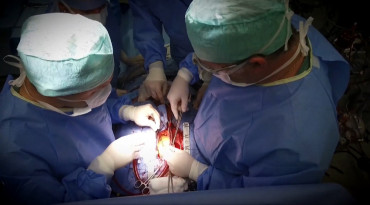 Transplantácia srdca